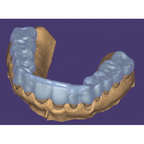 EXOCAD moduł BITE SPLINT wersja Flex